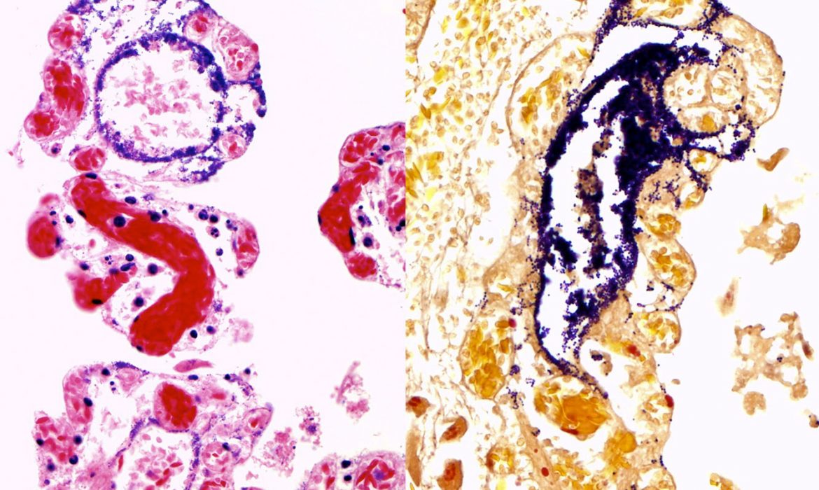 bacterias Streptococcus equi de la subespecie analizada, en color morado, invadiendo el intestino de las alpacas a través de los vasos linfáticos.