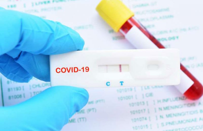La OCV advierte de que la infrautilización de los laboratorios veterinarios paraliza millones de diagnósticos de coronavirus entre la población española