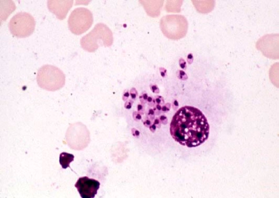 Fase intracelular del parásito Leishmania spp. en las células de la médula ósea de un perro. / CIB.